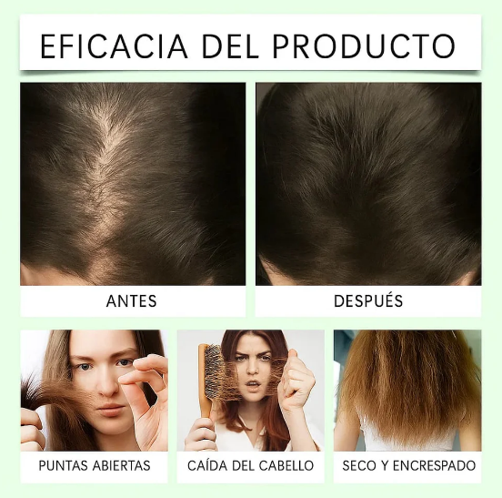 2X1 CHAMPÚ ACEITE DE BATANA CON EXTRACTO DE ROMERO 400 ML